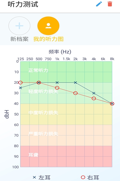 艾米助听